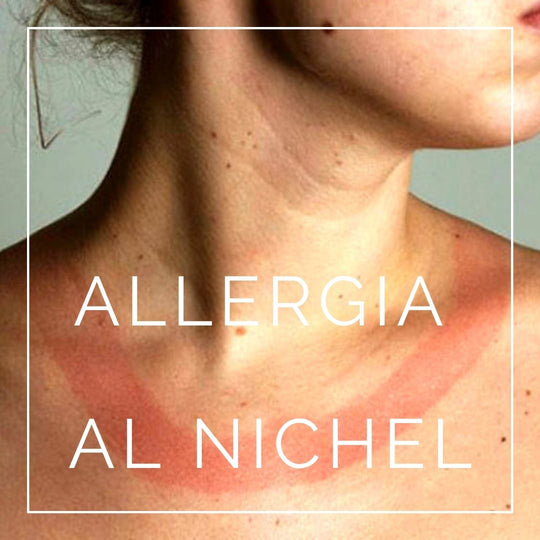 Allergia al Nichel: posso indossare i gioielli Atlantica? - Atlantica Store