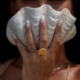 Anello ARAW